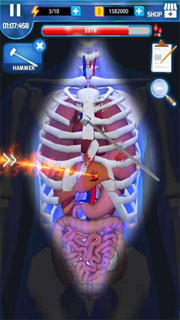 手术大师(Surgery Master)截图3